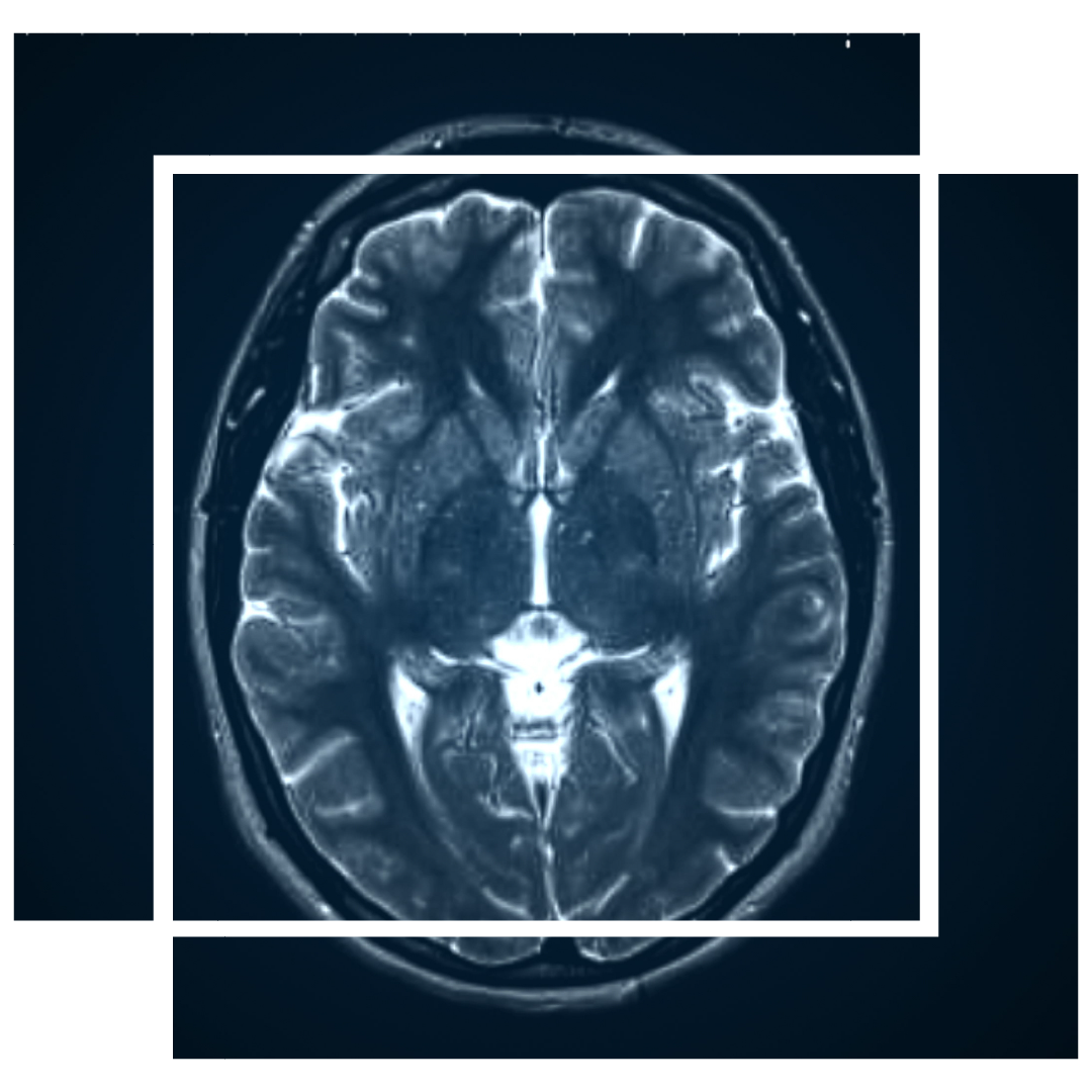 TMS Therapy Peaks Recovery Centers